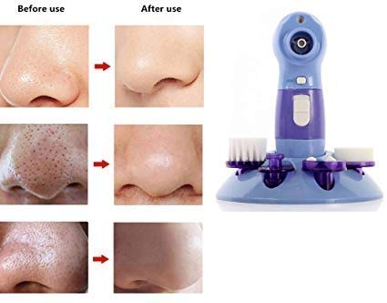 Giftock 4 in 1 Multifunctional Power Perfect Pore Facial Cleaning Brush Blackheads Remover Face Beauty Care Facial Massager Skin Care Cleaner Face Washing Machine Blackhead Remover(Pack of 1)
