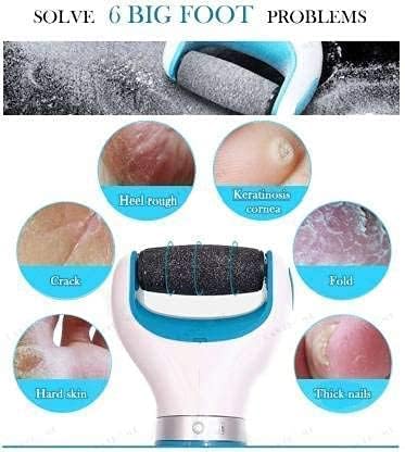 Giftock Dead Callus Remover Pedicure Device for Women Foot Scrubber for Dead Skin & Women Callus Remover for Feet Electronic Smooth and Soft Feet Scrubber Cracked Heels Remover (4-AA CELL INCLUDED)