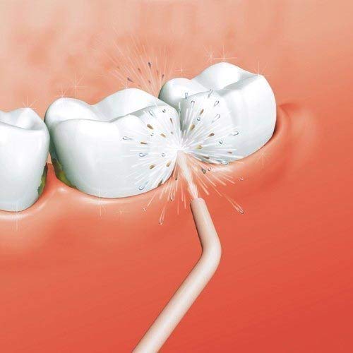 Giftock Speed Dental Care Water-Jet Flosser Tooth Pick Power Dental Cleaning Whitening Teeth Kit Power Floss Air Powered Dental Water Jet for Tooth Cleaner (White Coloured)