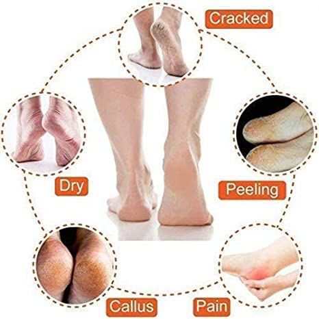 Giftock Heel Pain Relief Silicone Gel Pad Heel Protector Socks with Spa Botanical for Men and Women Cotton Socks (1 pair)