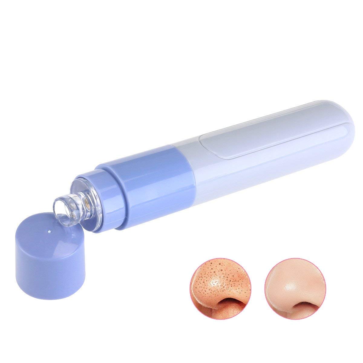 Giftock Mini Electric Portable Facial Pore Cleanser Skin Cleaner Face Dirt Suck Up Vacuum pore cleaner