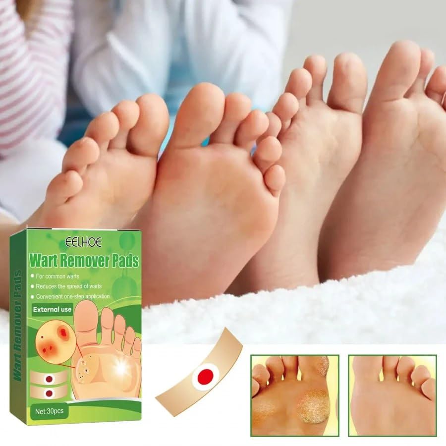 Giftock Foot Corn Removers Plaster with Hole,for Feet,Wart Remover, Wart Removal Plasters Pad,Feet Callus Remove, Soften Skin Cutin Sticker Cure Toe Protector, Relief Pain Removal Warts Plaster 24 Pcs/Box