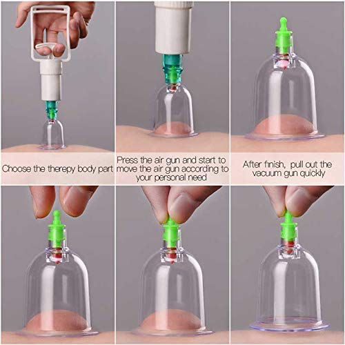 Giftock 12 Pcs Massage Cans Cups Vacuum Cupping Kit Pull Out Vacuum Apparatus Therapy Relax Massager Body Suction Pumps Hijama Cupping Kit Set