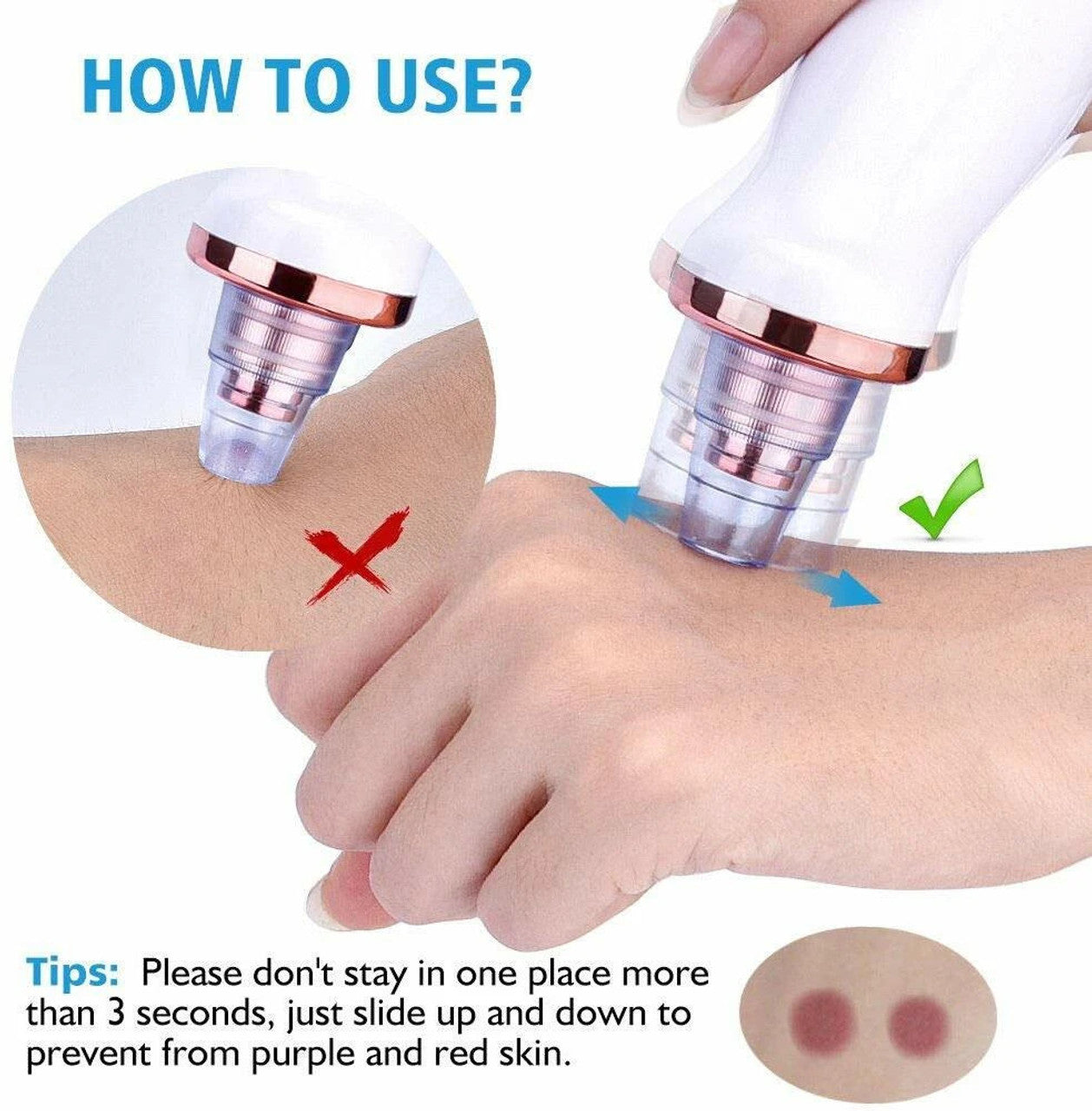 Blackhead Remover Derma Suction for Face