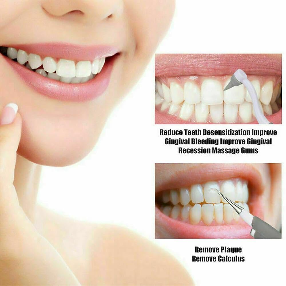 Giftock Portable Ultrasonic Electric Tooth Dental Cleaner With LED Light Stain Eraser Plaque Tartar Remover Teeth Whitening, Grey & White Color 1 Pcs
