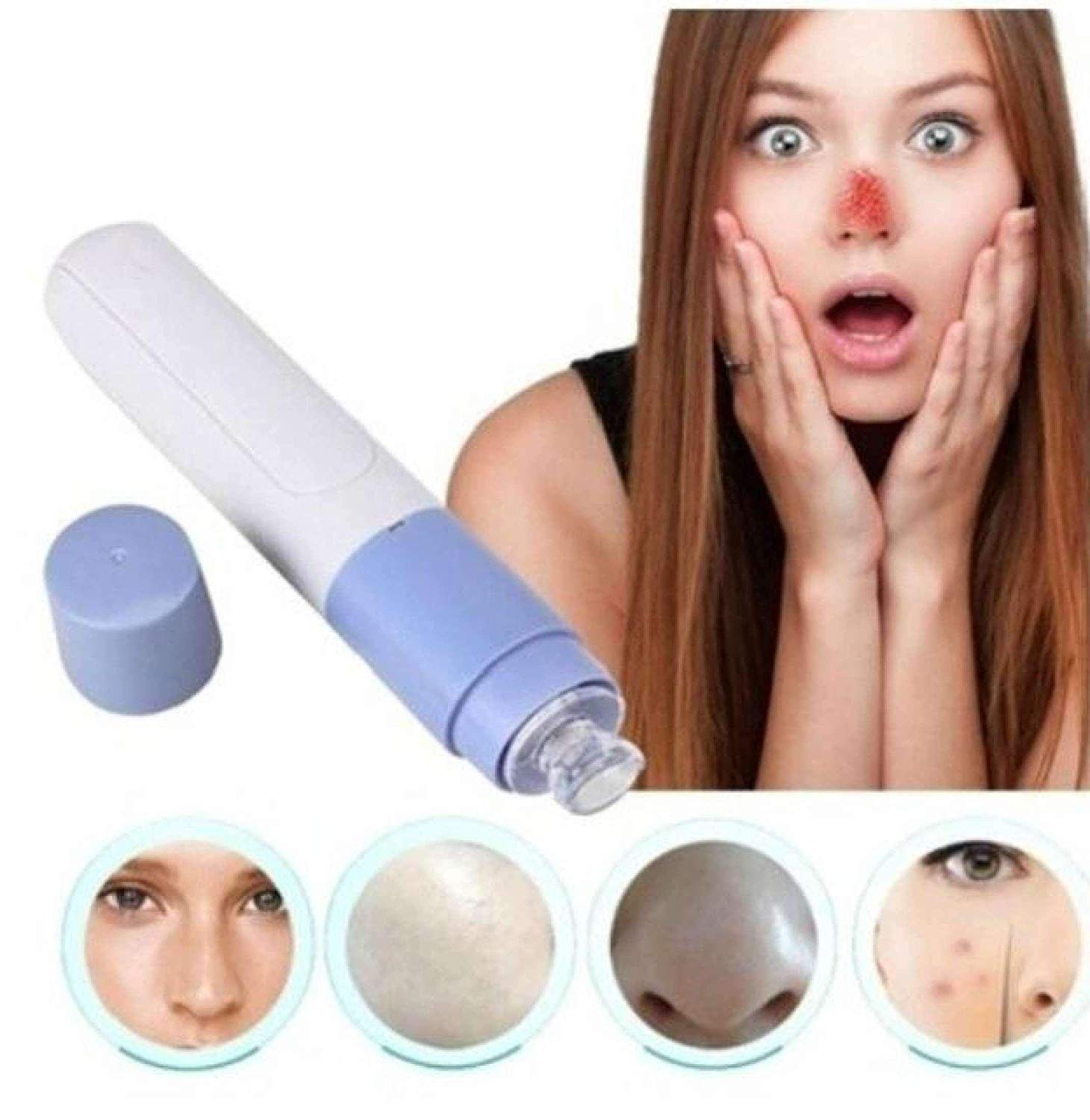 Giftock Mini Electric Portable Facial Pore Cleanser Skin Cleaner Face Dirt Suck Up Vacuum pore cleaner