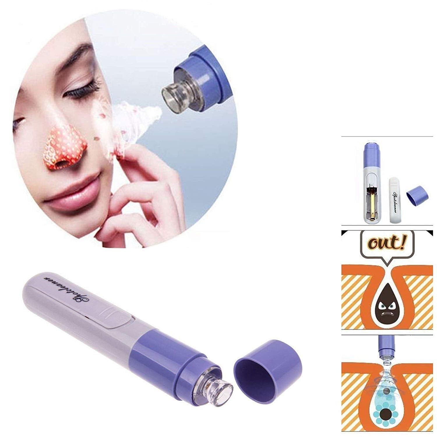 Giftock Mini Electric Portable Facial Pore Cleanser Skin Cleaner Face Dirt Suck Up Vacuum pore cleaner