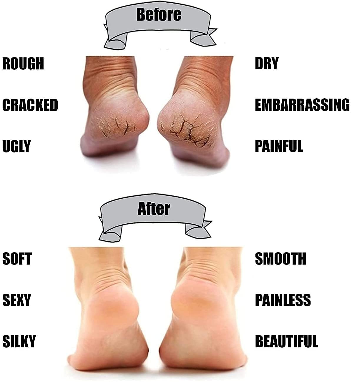 Giftock Anti Crack Full Length Silicone Gel Foot Protector Moisturizing Socks for Foot-Care and Heel Cracks Socks for Cracked Feet, Heel Pad for Heel Pain Relief Men And Women (Beige, Free Size)