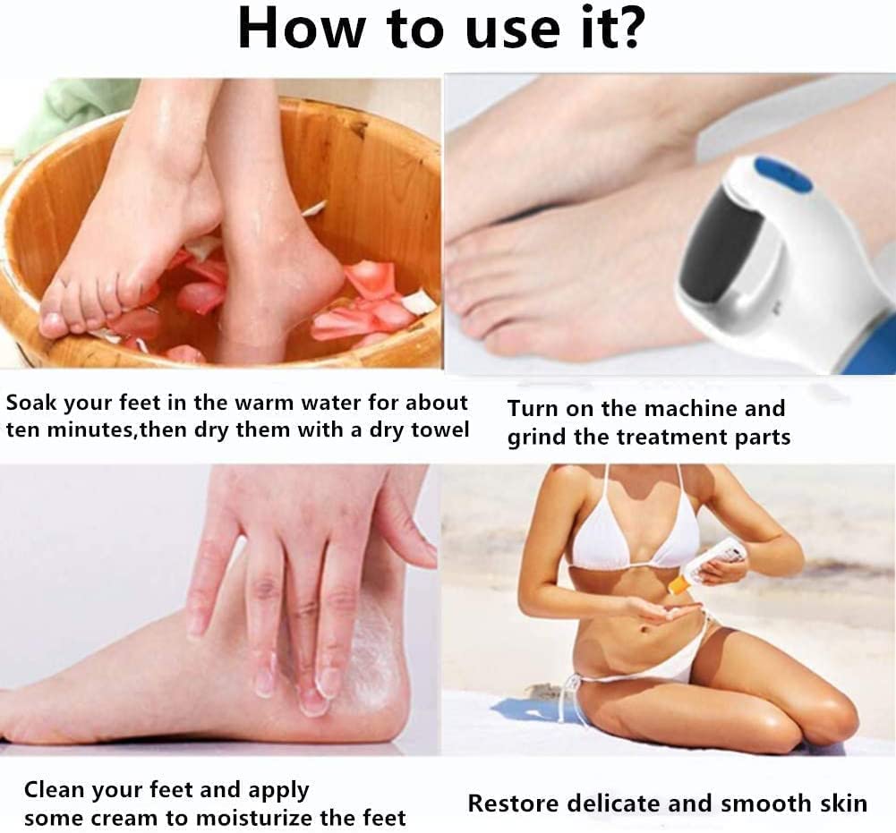 Giftock Dead Callus Remover Pedicure Device for Women Foot Scrubber for Dead Skin & Women Callus Remover for Feet Electronic Smooth and Soft Feet Scrubber Cracked Heels Remover (4-AA CELL INCLUDED)