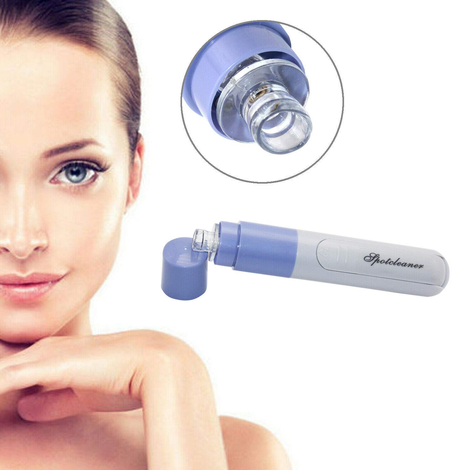 Giftock Mini Electric Portable Facial Pore Cleanser Skin Cleaner Face Dirt Suck Up Vacuum pore cleaner