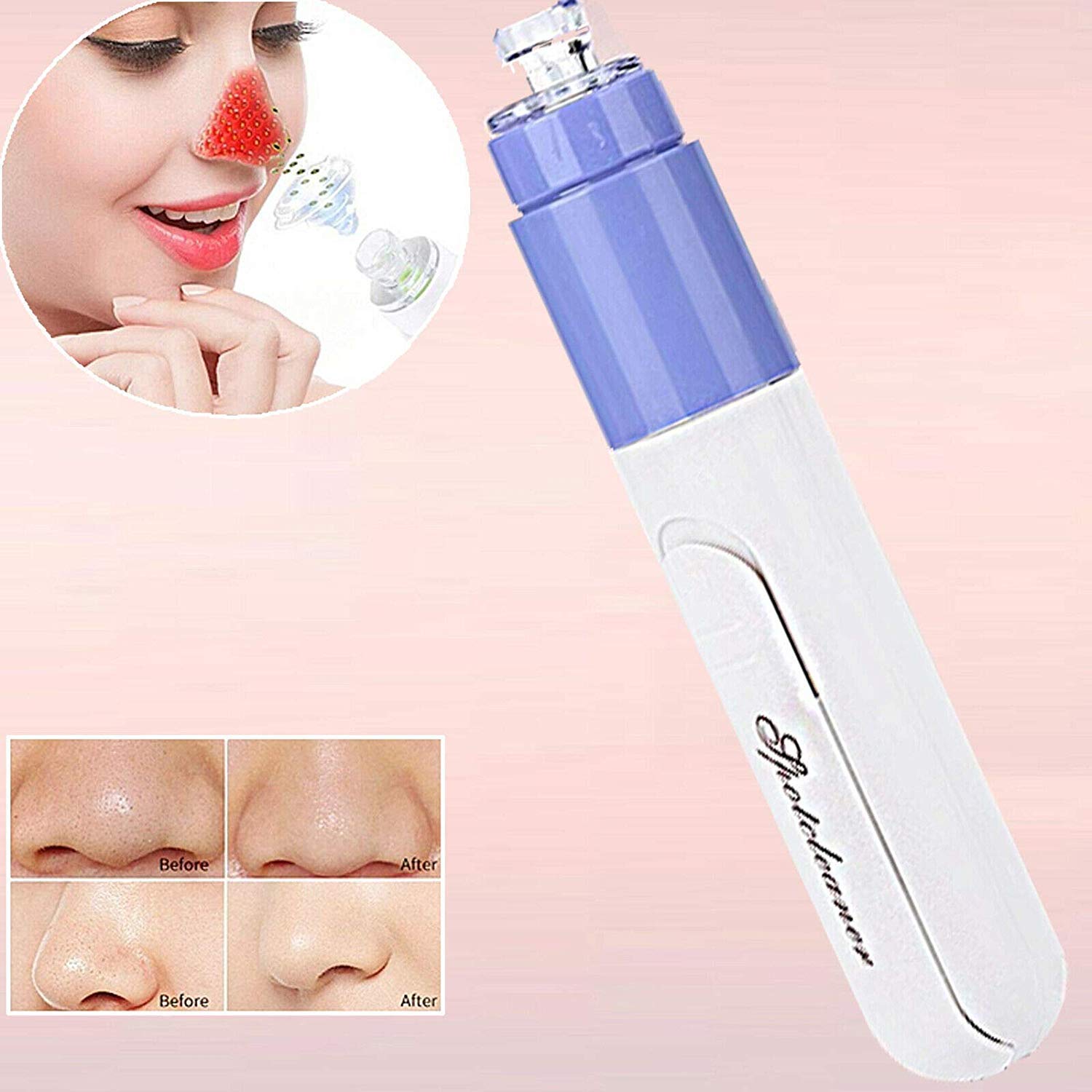 Giftock Mini Electric Portable Facial Pore Cleanser Skin Cleaner Face Dirt Suck Up Vacuum pore cleaner