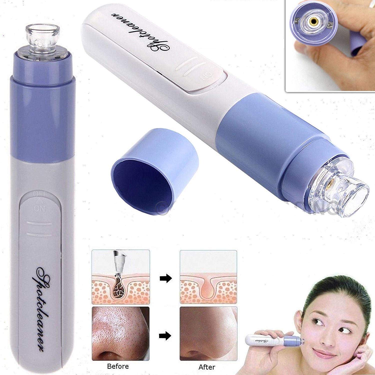 Giftock Mini Electric Portable Facial Pore Cleanser Skin Cleaner Face Dirt Suck Up Vacuum pore cleaner