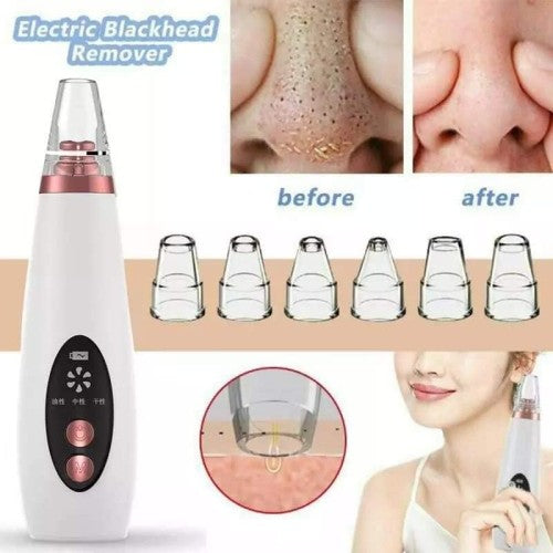 Blackhead Remover Derma Suction for Face